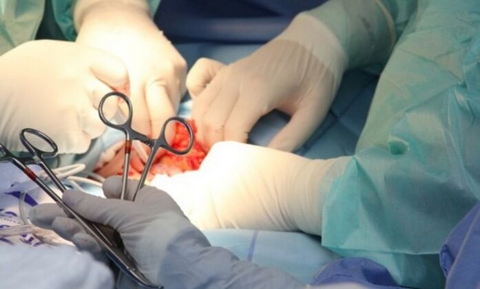 Ligamentotomi – penisi büyütme ameliyatı