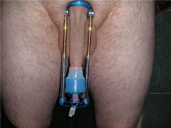 penis büyütme için genişletici